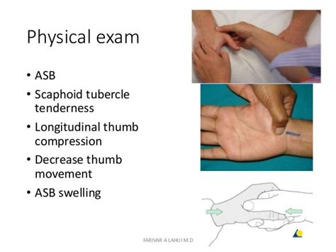 scaphoid fracture physical exam